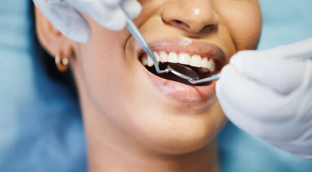 Best Emergency Dental Care for Broken or Chipped Teeth in Madera Ranchos, CA